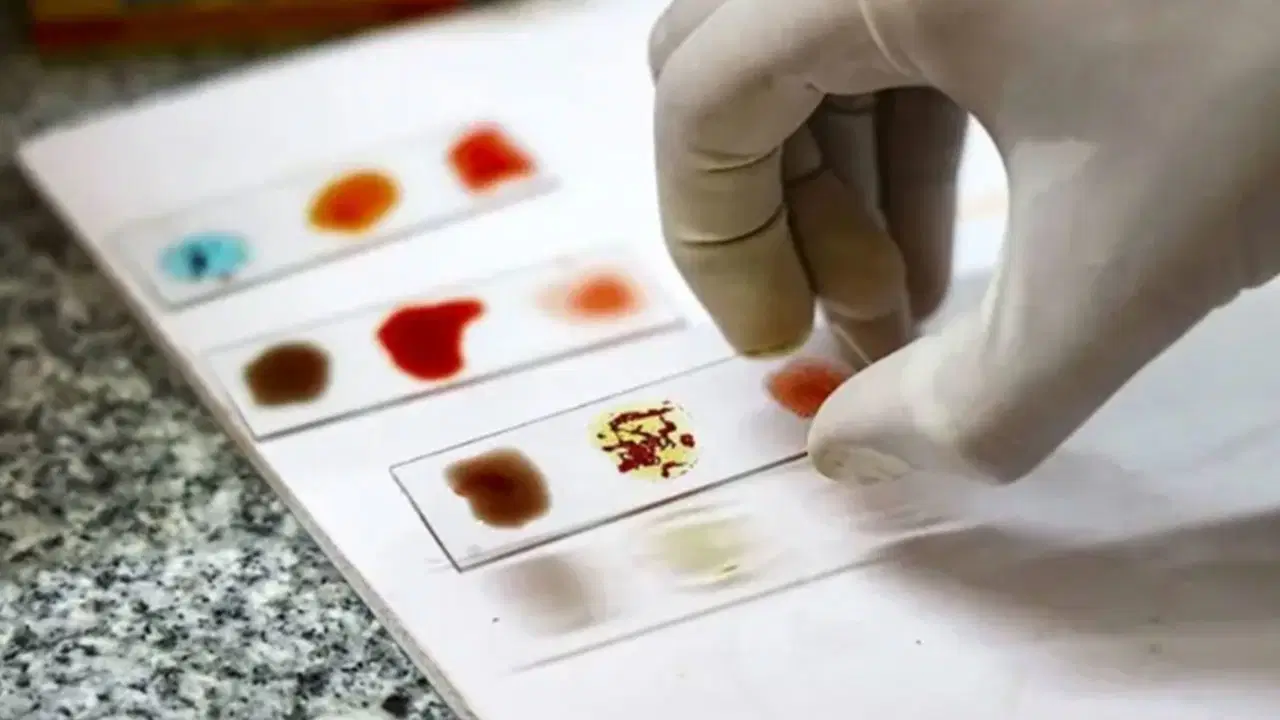 Dünyada sadece 50 kişide var! Evrensel donör olabilecek ‘altın kan’ türü nedir?