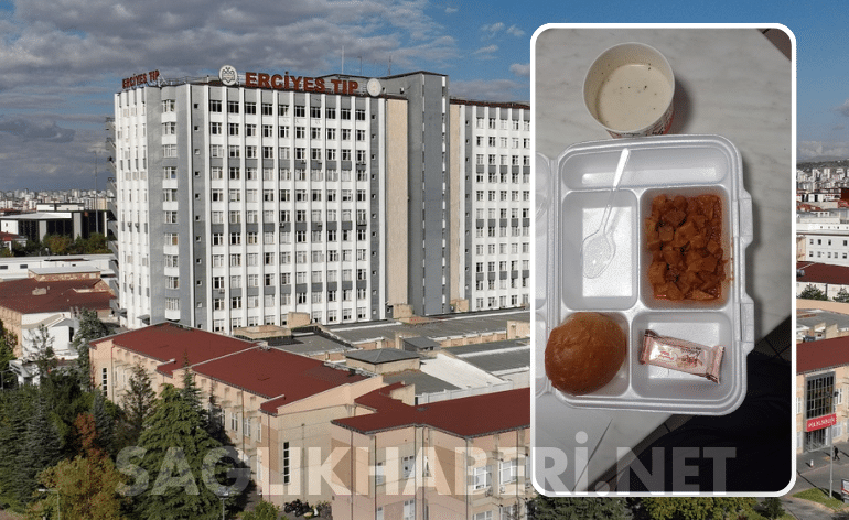 Erciyes Üniversitesi’nde Bardak Taştı: Nöbetçi Personele “Doyumluk Değil Tadımlık” Yemek! • Sağlık Haberi